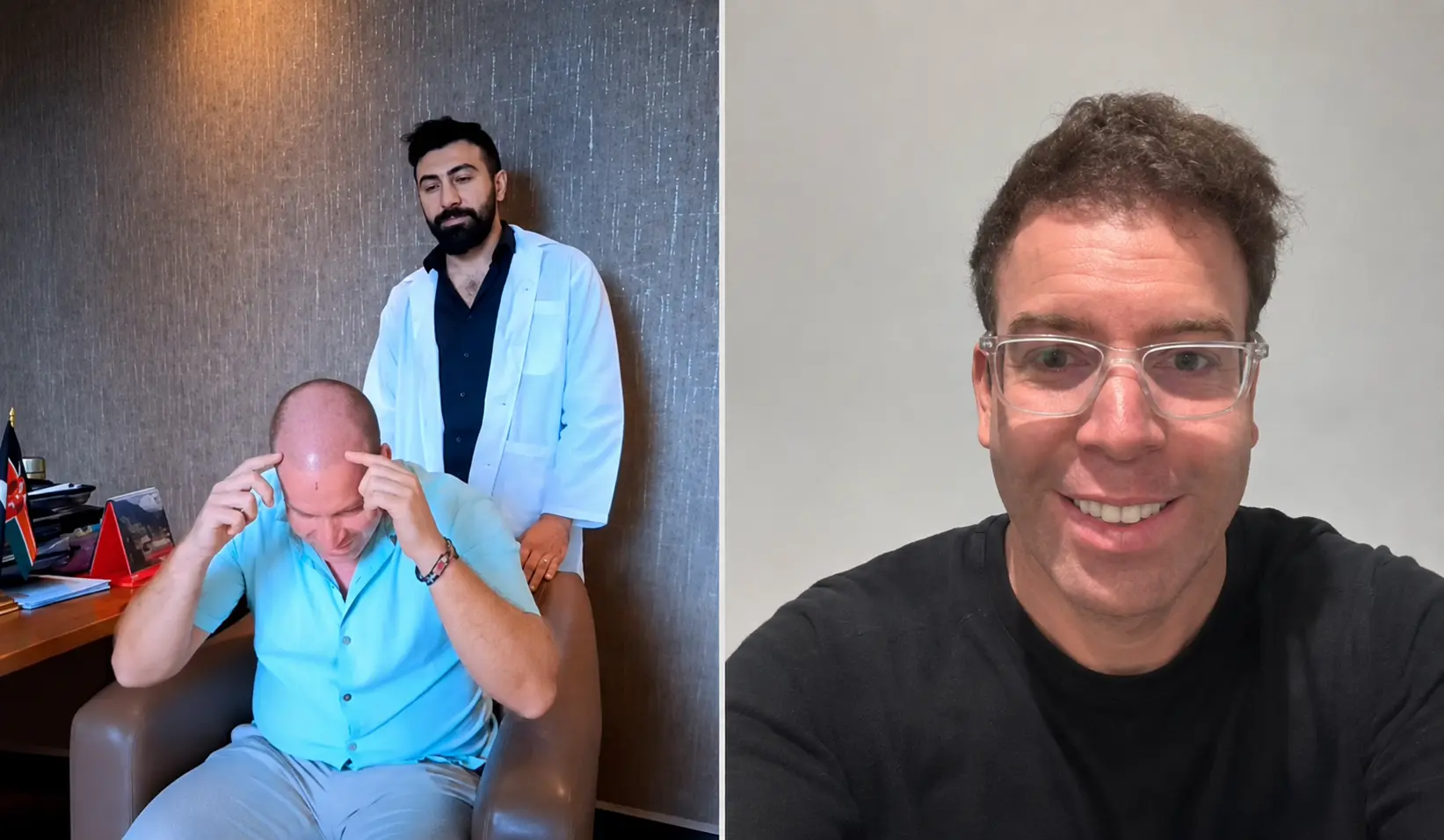Personal hairline design consultation for a premium hair transplant plan