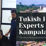 hair-transplant-kampala